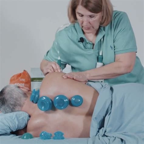 Image result for Cupping Tutorial