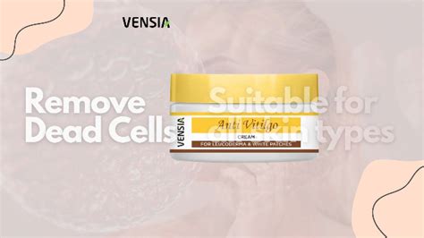 Watch VENSIA Anti Vitiligo cream on Amazon Live