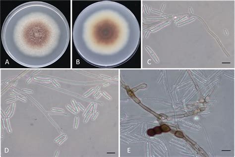 【附图】常见梭菌属菌种_微生物 | 天山医学院