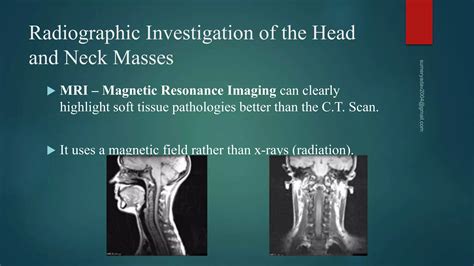 Neck mass differential diagnosis | PPTX