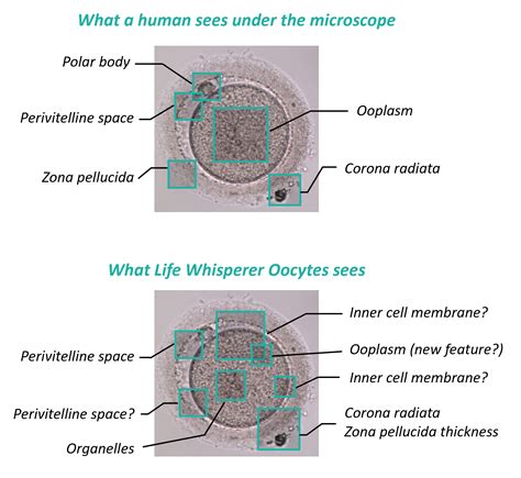 Life Whisperer Oocytes (LWO) | Life Whisperer