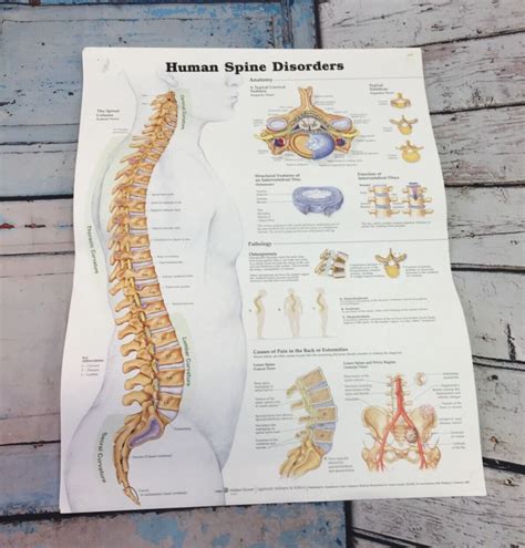 Human Spine Disorders