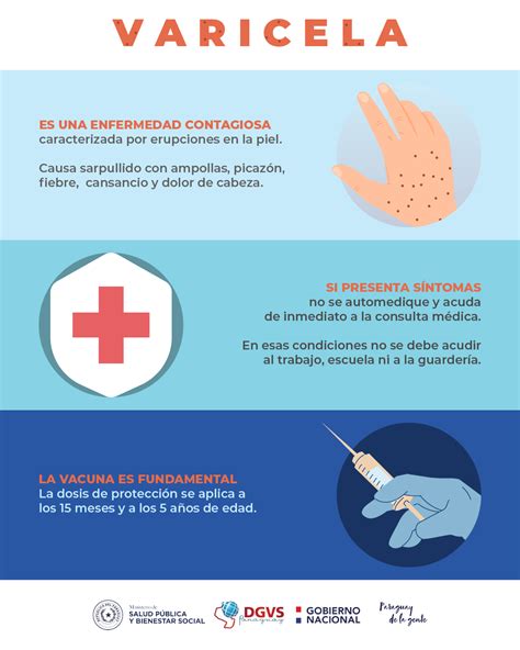 Se confirman brotes de varicela - DGVS