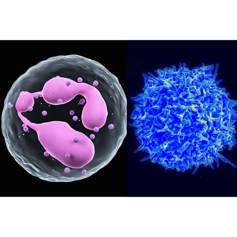 4 Reasons to Know the Neutrophil-to-Lymphocyte Ratio (NLR)