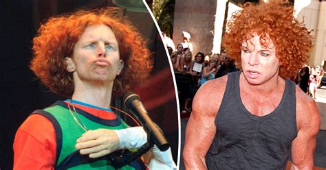 Carrot Top Before and After Speculated Plastic Surgery