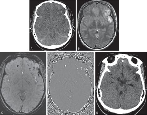 Brain Trauma - Clinical Tree