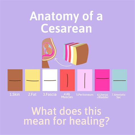 C-Section Recovery- The First 2 Weeks