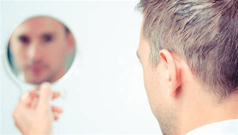 Quand est-ce que nous obtenons un résultat après la greffe de cheveux ...