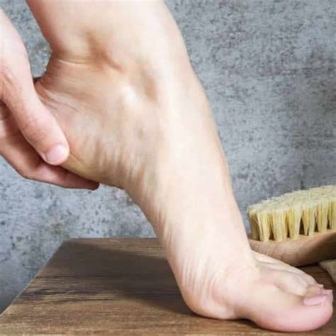 Diy Cracked Heel Treatment Discount Offers | www.pinnaxis.com