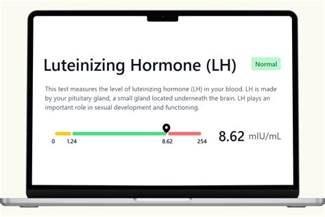 Luteinizing Hormone (LH) Blood Test - Men's Hormone Biomarkers – PlexusDx