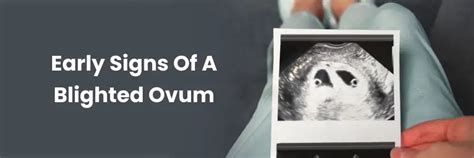 Early Signs of a Blighted Ovum: What Women Should Know
