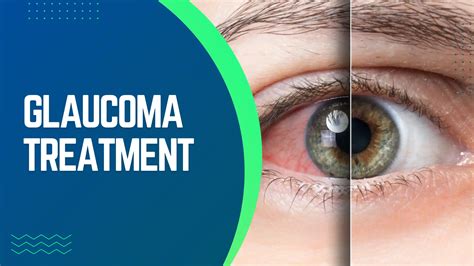 what is Glaucoma Treatment!?