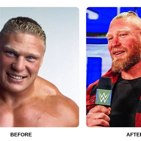 Cristiano Ronaldo Teeth Before and After: What Happened in His ...