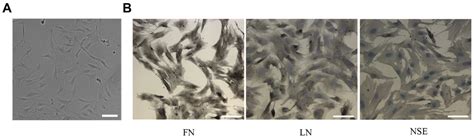 Effects of Ocular Hypertension on Cytoskeleton and Stiffness of ...