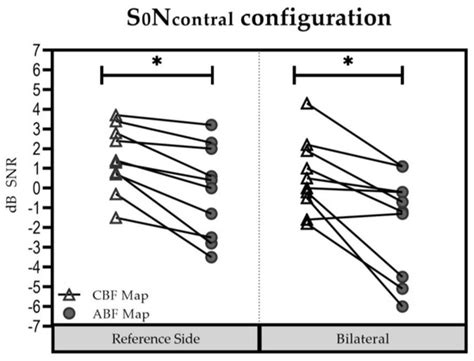 Using Anatomy-Based Fitting to Reduce Frequency-to-Place Mismatch in ...