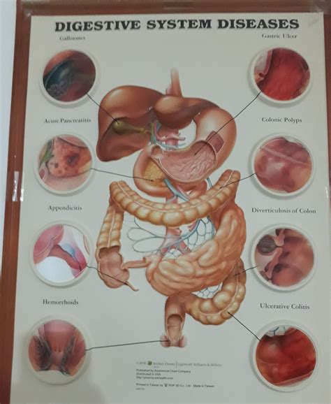Digestive System Diseases 的图像结果