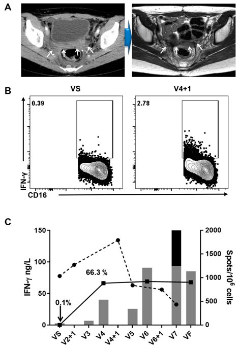 Phase I Study of a B Cell-Based and Monocyte-Based Immunotherapeutic ...