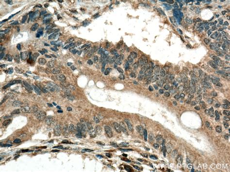 GPX8 antibody (16846-1-AP) | Proteintech