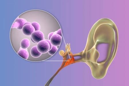 “超级真菌”是怎样炼成的？-黄广华课题组在临床耳念珠菌感染和传播机制方面取得重要进展 - 生物通