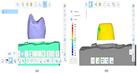 In Vitro Comparison of Monolithic Zirconia Crowns: Marginal/Internal ...