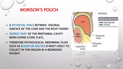 Surgical anatomy of liver | PPTX