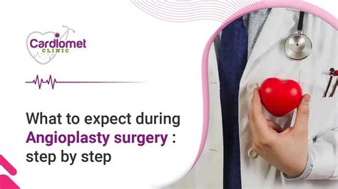 Angioplasty Surgery Procedure | Your Personal Step by step Guide