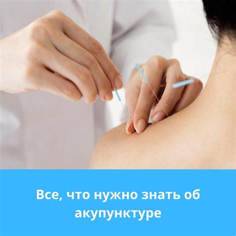 Акупунктура: описание | виды | применение