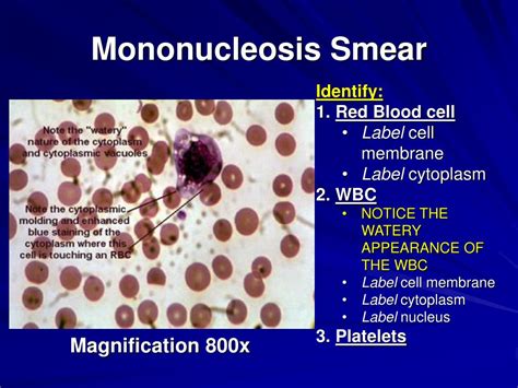 PPT - Lab #15 Blood PowerPoint Presentation, free download - ID:5364580