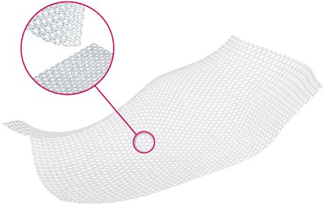 Silicone Wound Contact Layer - Advanced Medical Solutions