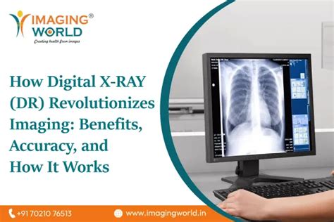 How Digital X-RAY (DR) Revolutionizes Imaging: Benefits, Accuracy, and ...