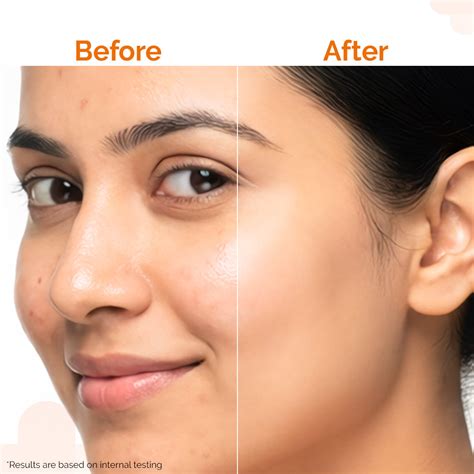 Niacinamide Sunscreen for Open Pores -80g | The Derma Co
