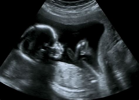 30 Weeks Ultrasound Boy
