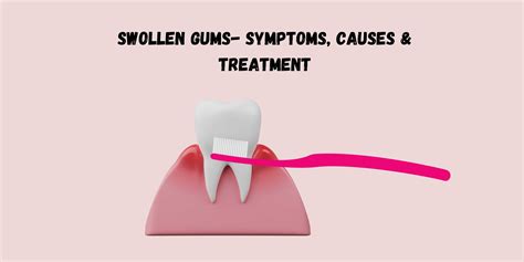 Swollen Gums- Symptoms, Causes & Treatment - PUREXA Oral Care