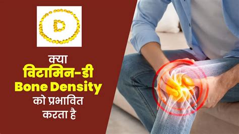 क्या विटामिन-डी Bone Density को प्रभावित करता है | Does Vitamin D ...