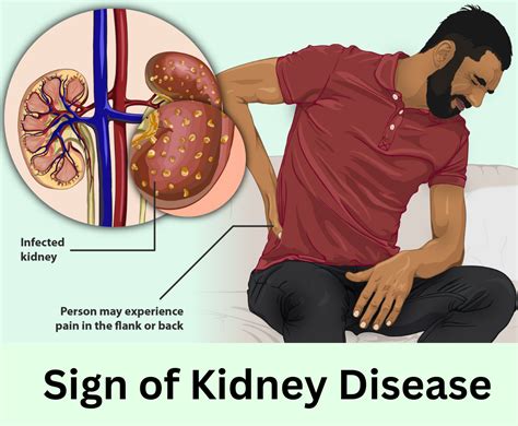 6 Warning signs of kidney disease - Sach ke saath