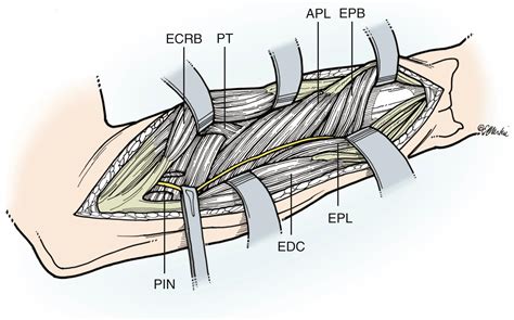 Disorders of the Forearm - Clinical Tree