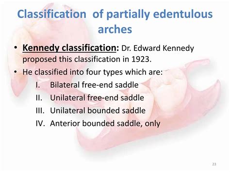 01- INTRODUCTION AND CLASSIFICATION PARTIAL DENTURE.pptx