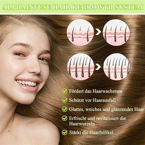 Soleneva Alphainfuse Hair Regrowth System Alpha Infuse Hair India | Ubuy