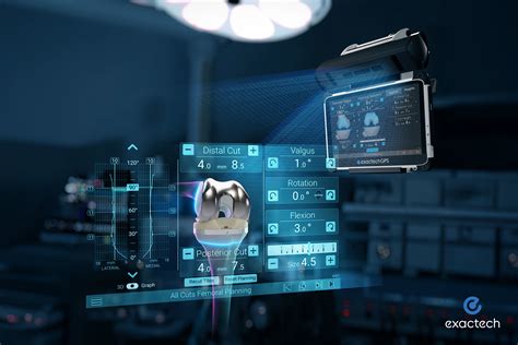 Exactech Enhances High Technology Knee System with New Balancing ...