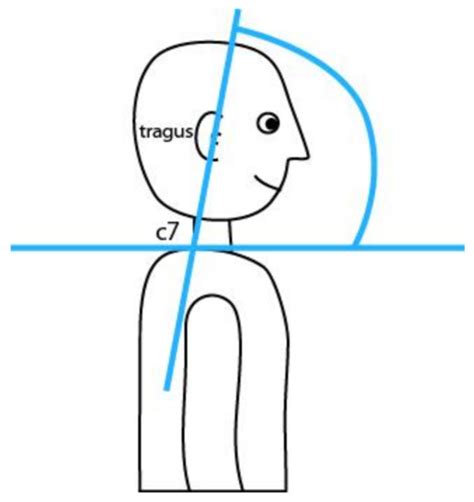 The Influence of the Schoolbag on Standing Posture of First-Year ...