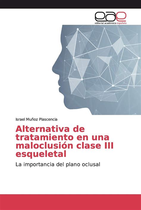 Buy Alternativa de tratamiento en una maloclusión clase III esqueletal ...