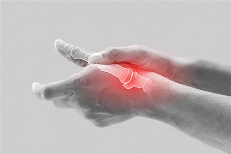 Jammed Thumb: Signs, Treatment, and Recovery | NatraCure - NatraCure