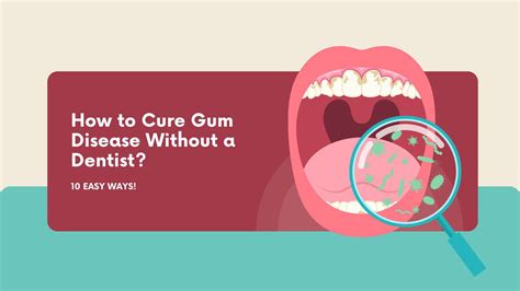 How To Cure Bad Breath From Gum Disease at Sean Hawker blog
