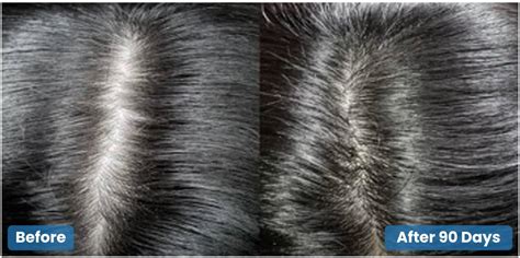 Power Gummies - Clinically Proven For Hair & Nails Gummies