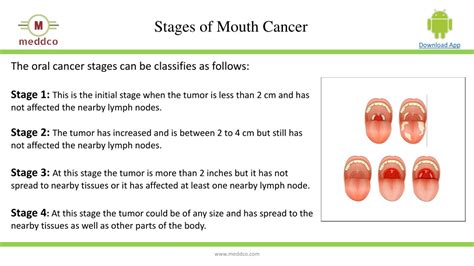 PPT - Oral Cancer Awareness-Causes, Symptoms & Diagnosis| Meddco Healthcare PowerPoint ... - causes of mouth cancer