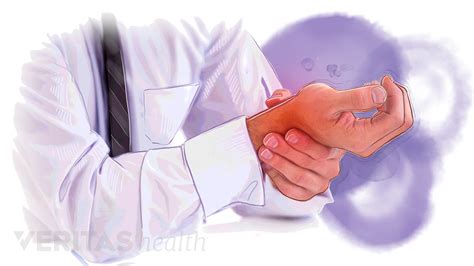 Symptoms of Wrist Tendonitis