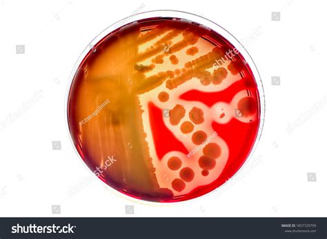 Bacteria Hemolysis Blood Agar at Isabel Kleeman blog