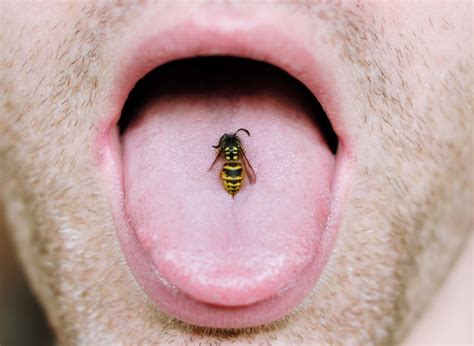 Carpenter Bee Sting Reaction