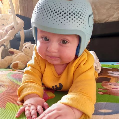 Infant Helmet Flat Head No #1 Cranial Remolding Helmet For Newborns In