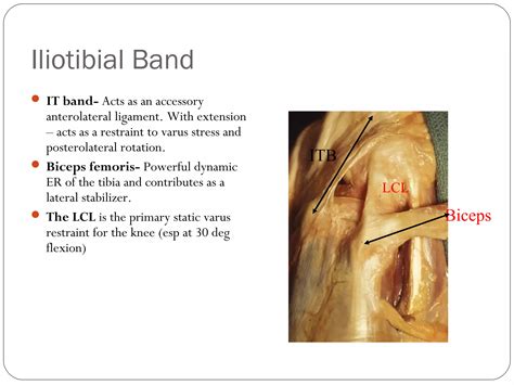 Posterolateral corner injuries of knee joint | PPT